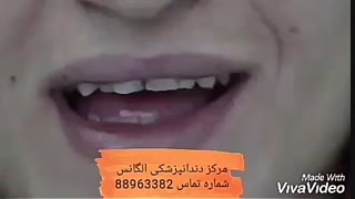 بهترین دندانپزشکی اطفال | بهترین متخصص لمینیت دندان |قیمت فلوراید تراپی | فیلم فلوراید تراپی