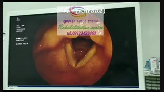 مرکز تخصصی عکس برداری رنگی حنجره09121623463|۴۵متری گلشهر خیابان گلزار اصلی درختی