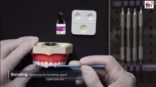 آموزش ترمیم زیبایی دندان