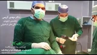 الیزاروف چیست و چه کاربردهایی دارد
