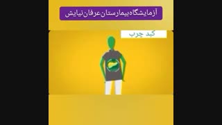 آنچه که باید در مورد کبد چرب بدانید