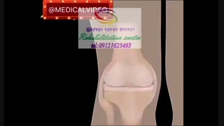 پیشرفته ترین مرکز کاردرمانی در البرز 09121623463|مهرشهر خیابان گلستان فرعی شرقی ۱۱۲