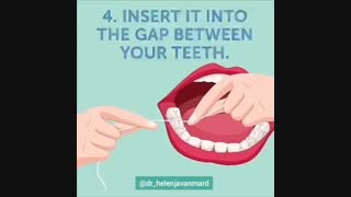 روش صحیح نخ دندان کشیدن