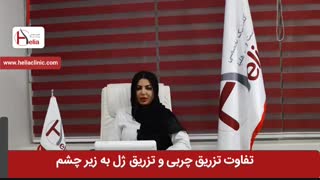 تزریق ژل یا چربی زیر چشم چیست؟ | کلینیک هلیا | 02122819418 برداشتن خال گوشتی