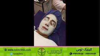 پاکسازی پوست (فیشیال)