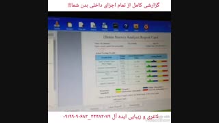 چکاپ کامل بدن با بیواسکن