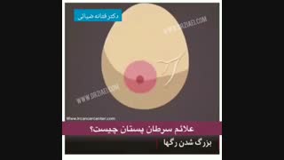 علائم سرطان پستان چیست