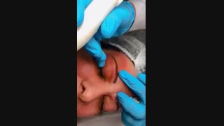 پلاسمای پلک چیست؟