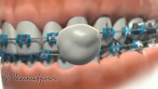 اورژانس ها ارتودنسی | دکتر همت پور