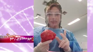 جراحی میوم 10سانتی متری