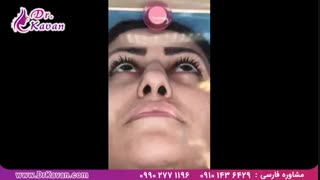 جراحی زیبایی بینی