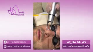 درمان کک و مک کلینیک مو