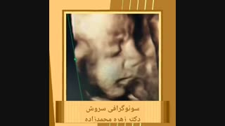 سونوگرافی چهار بعدی کل بدن جنین