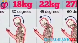 فیلم آسیب به مهره گردن