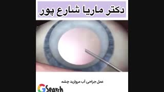 جراحی آب مروارید