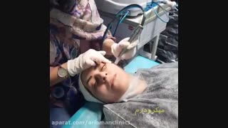 جوانسازی پوست در کلینیک آریامن | میکرودرمینگ | نخ لیفت 02188210135 عصب‌کشی