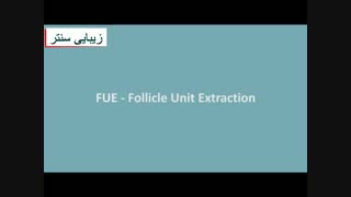 کاشت مو - آشنایی با مراحل پیوند مو - زیبایی سنتر