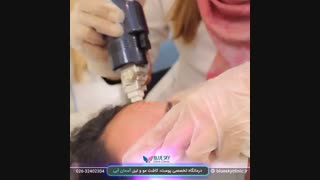 آر اف فرکشنال - 02632402304 پروتز دندان