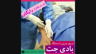 تزریق چربی به دست با دستگاه بادی جت
