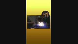 تومور بزرگ تیروئید