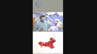 جراحی تمیز کردن گردن