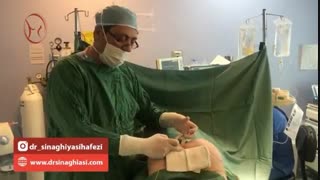 پروتز باسن