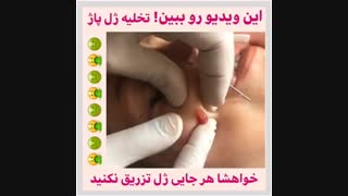 تخلیه ژل پاژ