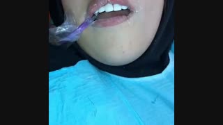 فیلم کامپوزیت ونیر