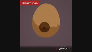 علائم سرطان سینه