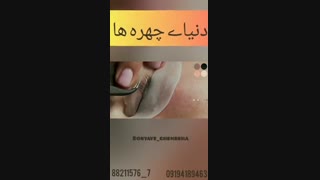 فیلم قبل و بعد لیفت و لمینت مژه
