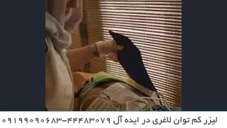 لیزرکم توان و لاغری موضعی عالی