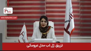تزریق ژل لب مدل عروسکی | کلینیک هلیا | 02122819418