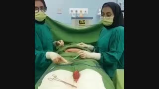 فیلم عمل جراحی هیسترکتومی