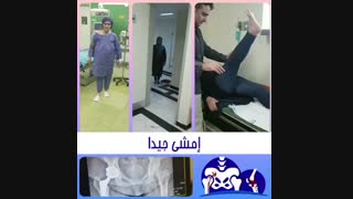 استبدال مفصل الحوض منذ الولاده