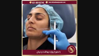 تزریق بوتاکس در تهران