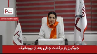جلوگیری از برگشت چاقی بعد از عمل لیپوماتیک | کلینیک هلیا | 02122819418