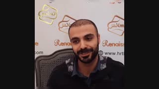 کاشت مو رنسانس - کلینیک تخصصی رنسانس پوسیدگی دندان