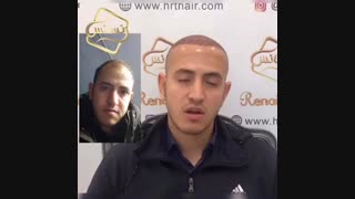 کاشت مو رنسانس - کلینیک تخصصی رنسانس رادیوگرافی دندان