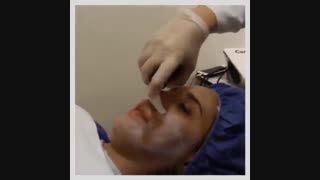 لاین فیشال و پاکسازی پوست