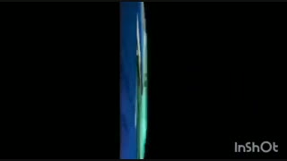 فیلم زایمان سزارین