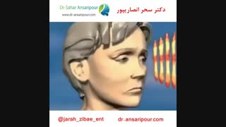 عمل جراحی زیبایی و جوان سازی در یک نگاه کوتاه