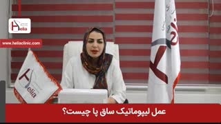 عمل لیپوماتیک ساق پا چیست | کلینیک هلیا | 02122810089