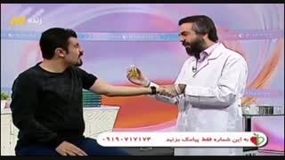 انواع بادکش