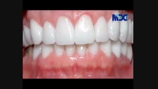 تشخیص لثه سالم از لثه ناسالم